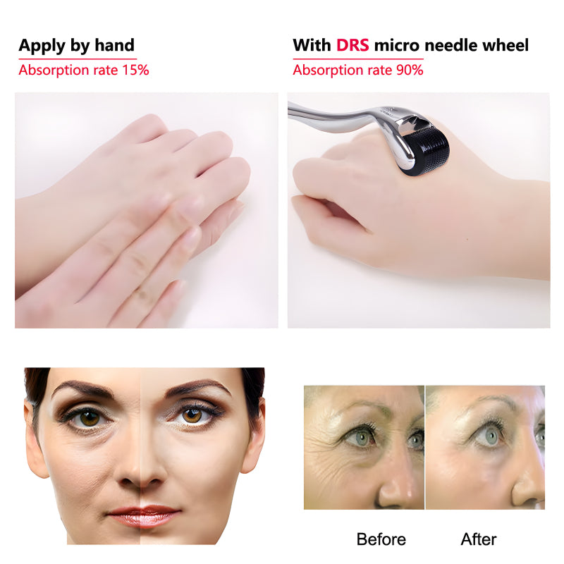 Pack Of 2 0.5mm Multi Function Microneedle Derma Roller Facial Arm Neck Massage Skin Care Tools