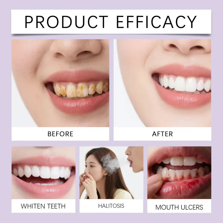 Purple Teeth Whitening Strips Instant Stain Correction (Pack of 7)